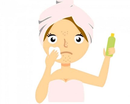 What are the natural ways to treat acne? Get rid of acne without chemicals.